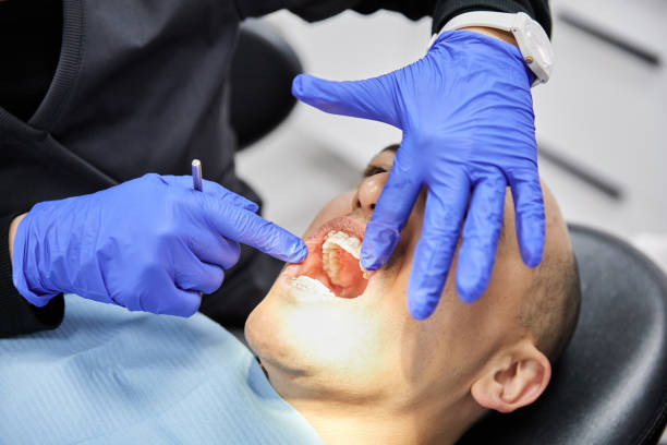 Best Emergency Dental Extractions in Connellsville, PA